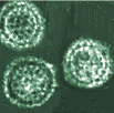 Elektronenmikroskopisches Bild des Hepatitis B Virus