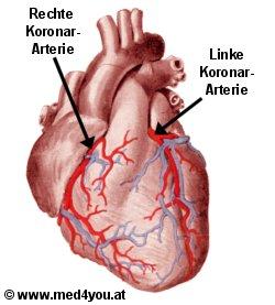 Herz von vorne: Herzkranzgefäße (Arterien=Schlagadern rot eingezeichnet)