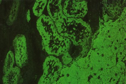 Fluoreszenzmuster eines LKM-Antikörpers auf Rattenleber/-niere