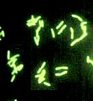 Legionellen mit fluoreszierendem Antikörper markiert