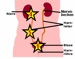 Ursachen der Proteinurie "nach der Niere"