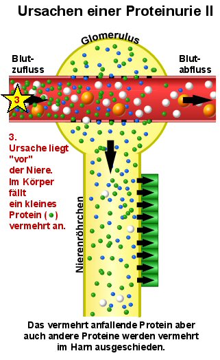Schematische Darstellung der Überlaufproteinurie