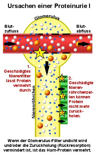 Schematische Darstellung der glomerulären und tubulären Proteinurie