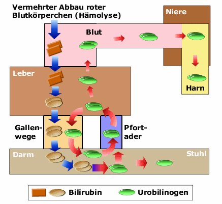 Vermehrung von Urobilinogen bei Hämolysen (Zerstörung roter Blutkörperchen)