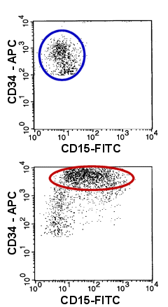 CD15 und CD34 auf einer Zellpopulation ist abnorm