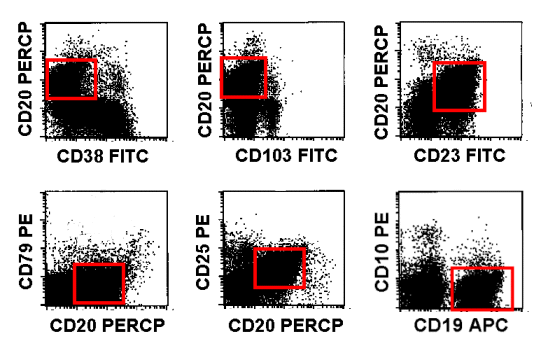Die malignen B-Zellen sind immer die schwach CD20-positiven (rote Kästchen)