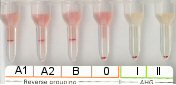Serumgegenprobe (A1, A2, B und 0-Zellen) bei Blutgruppe 0 inkl. Antikrperscreening bei Raumtemperatur