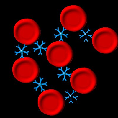 "IgM-Antikörper" binden an roten Blutkörperchen und führen zu einer "Verklumpung"