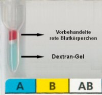 Pipettierschema für Blutgruppen- und Rhesuskarte